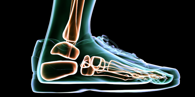 What Are Custom Foot Orthotics?
